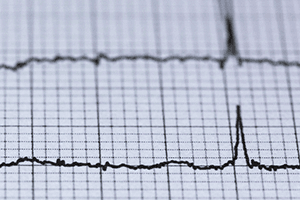 Printout of an EKG, a seismograph, or a polygraph.